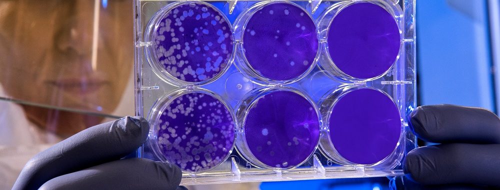 Coronavirus : une nouvelle épidémie d’ampleur?