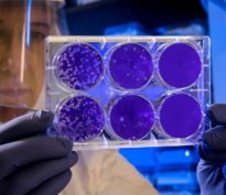 Coronavirus : une nouvelle épidémie d&rsquo;ampleur?