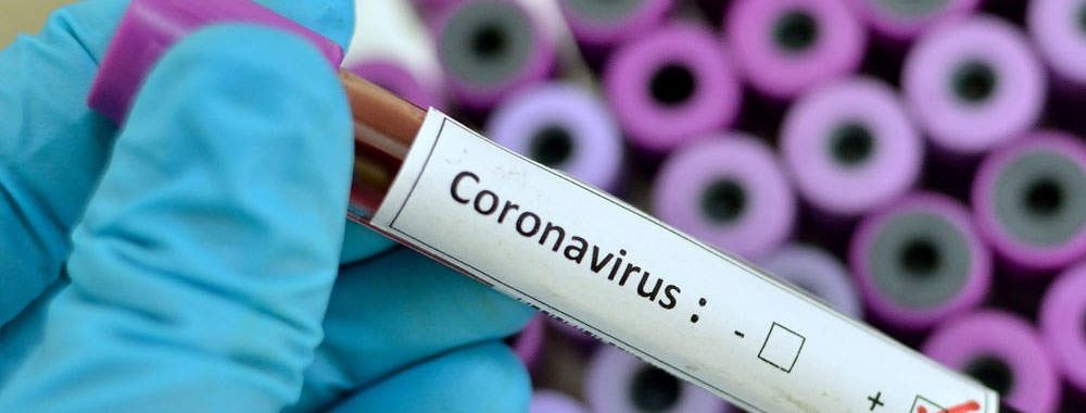 L’irruption du coronavirus inquiète les marchés obligataires